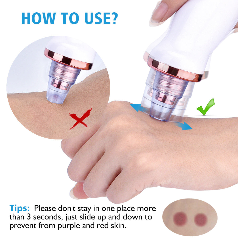 Electric Blackhead Suction Remover with Multi-Level Settings